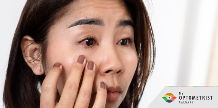 How Diabetes Affects Your Eyes: 5 Early Warning Signs Calgary Patients Shouldn’t Ignore