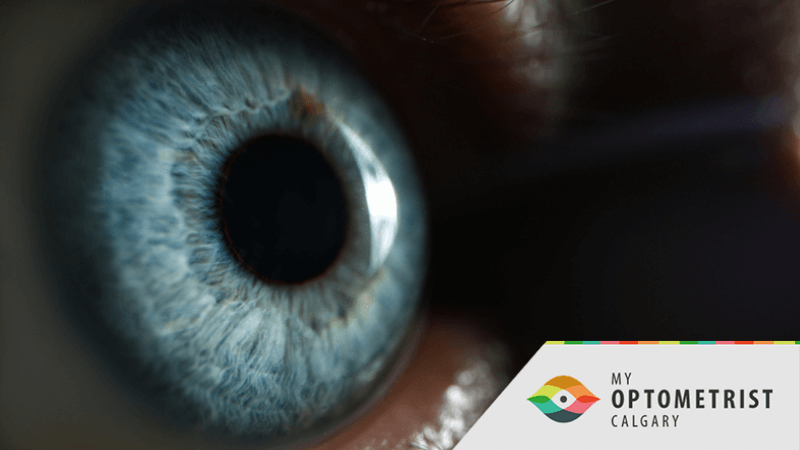 Dr. ​Osiowy Answers Your Cataract Questions